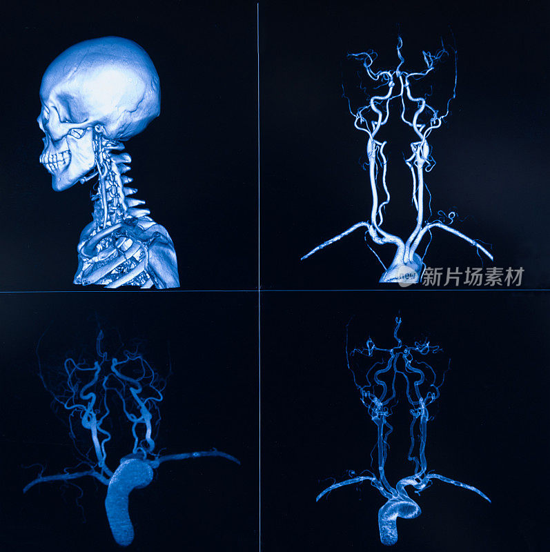 CT/ x线/MRI全身综合检查